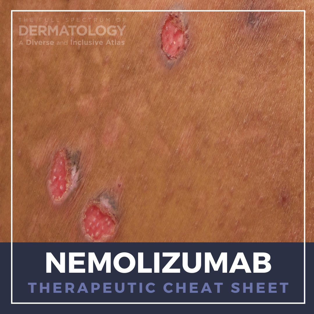 Nemolizumab Therapeutic Cheat Sheet Next Steps In Dermatology Nemolizumab Therapeutic Cheat Sheet Next Steps In Dermatology